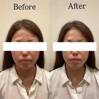 seika🍒 ハリラウンジ梅田のエステ・リラクイメージ