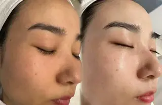 ネイル aliaハーブ水光店 エステティシャン募集のエステ・リラクイメージ