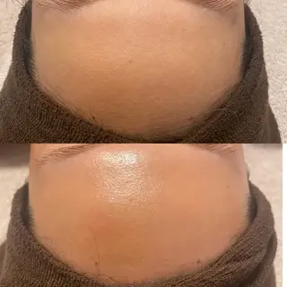 フェイシャル専門店　regalo所属・フェイシャル専門店 regaloのエステ・リラクイメージ