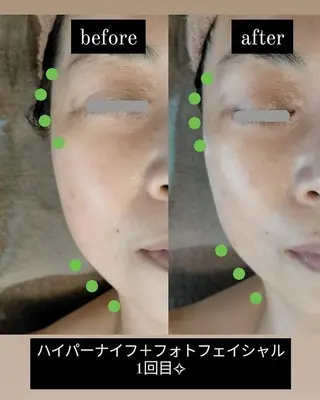 km retreat mentのエステ・リラクイメージ