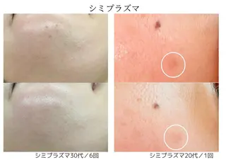 小顔＆肌質改善 NICORIのエステ・リラクイメージ