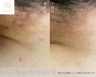脱毛・眉毛・フェイス サロンN久留米店の眉毛・アイブロウイメージ