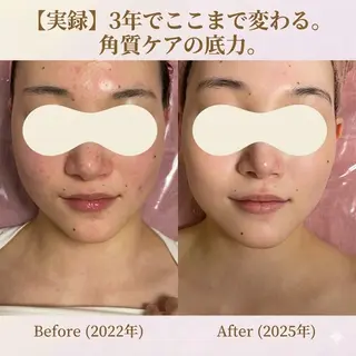 Linomalie エステ/たるみ/脱毛のエステ・リラクイメージ