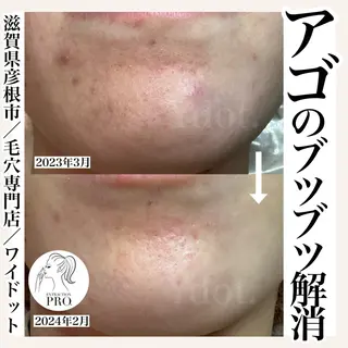 Ydot. 池内 友架のエステ・リラクイメージ