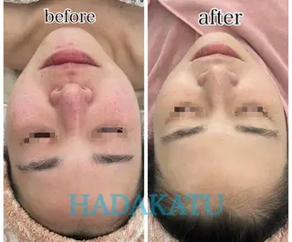 総合エステサロン 肌活のエステ・リラクイメージ