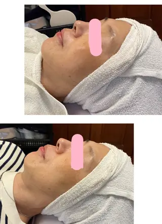 ネイル＆脱毛 Lotus🌸のネイルデザイン