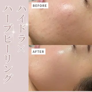 プライベートサロン Belle（ベル）のエステ・リラクイメージ