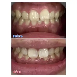 Ｍ渋谷 ホワイトニングのエステ・リラクイメージ