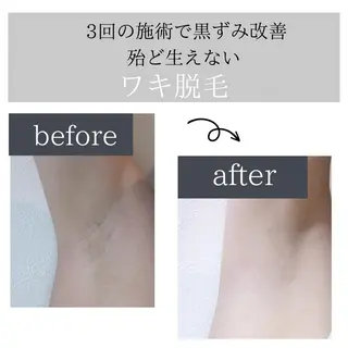 脱毛サロン Lokahiのエステ・リラクイメージ