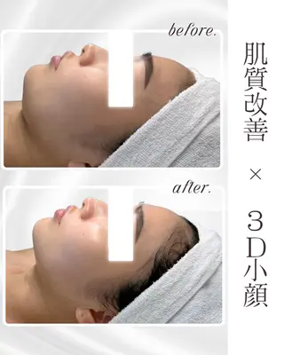 LiAm《美肌管理/ 小顔/脂肪ケア》のその他イメージ