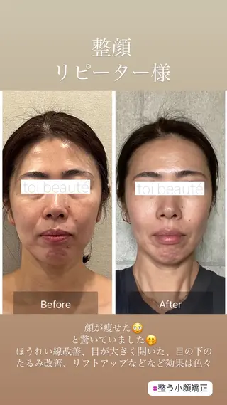 柳瀬 絵美のマツエク・マツパデザイン