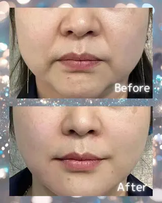 マツエク・マツパ aliaハーブ水光店 エステティシャン募集のエステ・リラクイメージ