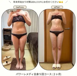 《本気痩せ×疲労改善 》  BILOOPのエステ・リラクイメージ