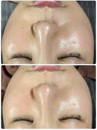 エステ／ネイル/脱毛 R.Msalonのネイルデザイン