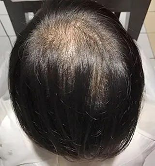 HFケアサロン NOBUKOのエステ・リラクイメージ