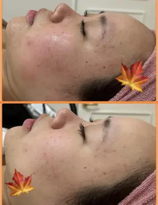 ショート ♡RAYVIS♡ 名古屋店　神田のエステ・リラクイメージ