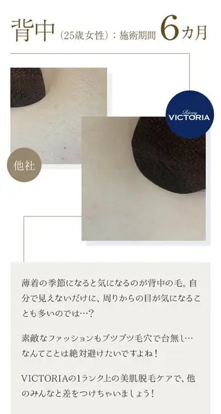 Butterfly 津田沼店　松井のエステ・リラクイメージ