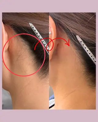 毛穴専門サロン Hanabiのエステ・リラクイメージ