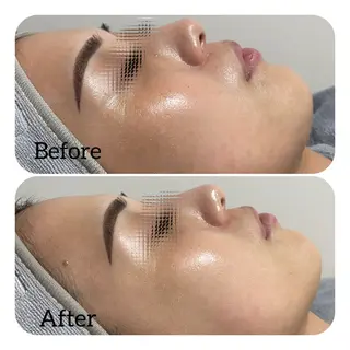 Éclat de Belle🫧白玉肌のその他イメージ