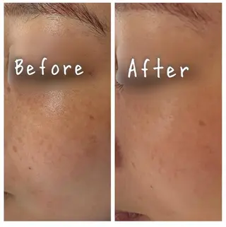 ナスサロ nozomiのエステ・リラクイメージ