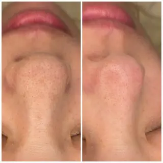 E LINDAのネイルデザイン