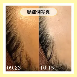 金山/脱毛/美肌 ULULUのエステ・リラクイメージ