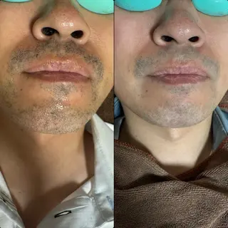 六本木脱毛andS Saoriのエステ・リラクイメージ