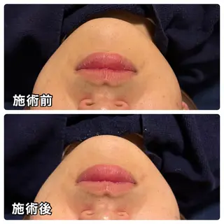 🌴Beauty Salon LANAのエステ・リラクイメージ