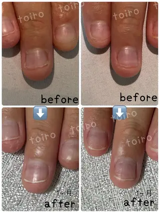 ネイル ネイルケア&自爪育成 専門サロンToiroのネイルデザイン