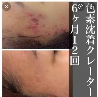 beauty salon epのエステ・リラクイメージ