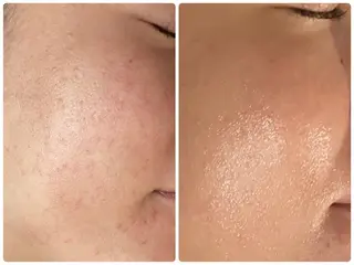 韓国肌管理★ 聖のエステ・リラクイメージ