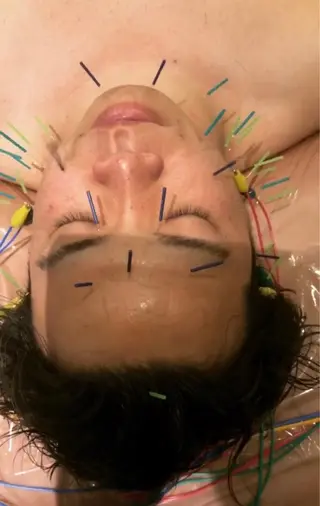 美容鍼灸サロン mahoroba院長のエステ・リラクイメージ