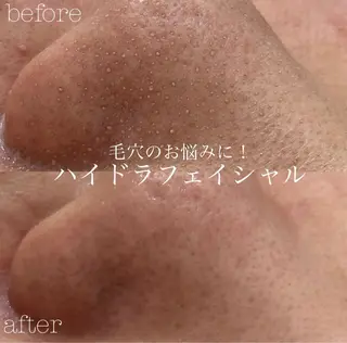 フェイシャルサロン CHIARA 荒田のエステ・リラクイメージ