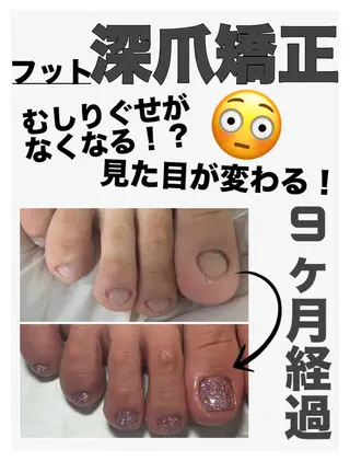 ネイル nail salon petillantのネイルデザイン