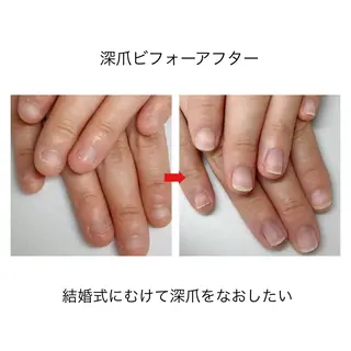 ネイル ネイルサロン アリュームのネイルデザイン