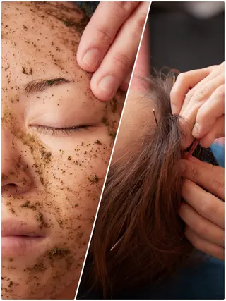 美楽鍼 びらくしんのその他イメージ