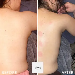 SHARES MADOKAのエステ・リラクイメージ