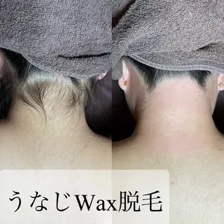 エピナス町田店 ブラジリアンワックスのエステ・リラクイメージ