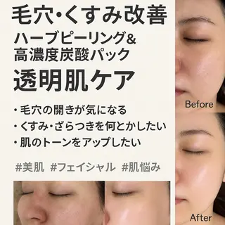 【歴13年】劇的小顔 D rマジックタッチのエステ・リラクイメージ