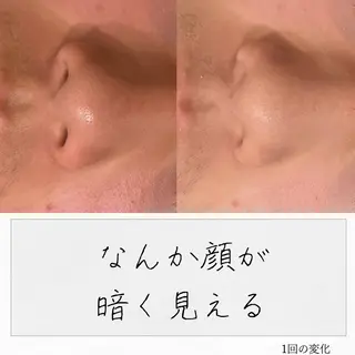 ニキビ経験者が施術 する専門サロン🌻のエステ・リラクイメージ