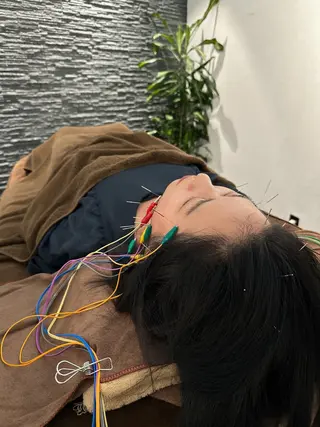 小顔矯/美容鍼/鍼灸 BeauJuのその他イメージ