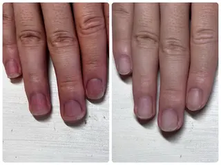 ネイル 深爪矯正・自爪育成 ヴェールリムのネイルデザイン