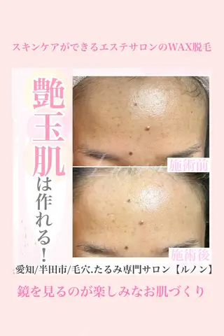 毛穴.たるみ専門店 Lunonのエステ・リラクイメージ