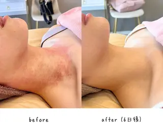 肌質改善🌿 彩也乃のエステ・リラクイメージ