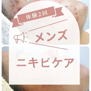 ニキビ・ニキビ跡専門 レゾン京橋店 のエステ・リラクイメージ