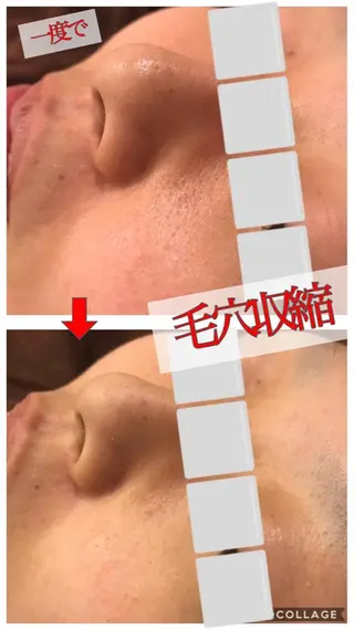 セミロング カラー パーマ ヘアアレンジ メンズ キッズ ネイル マツエク・マツパ 金の糸脱毛 産毛ケア専門のエステ・リラクイメージ