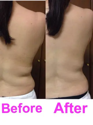 メンズ 朝重い人専用 肩甲骨調整のエステ・リラクイメージ