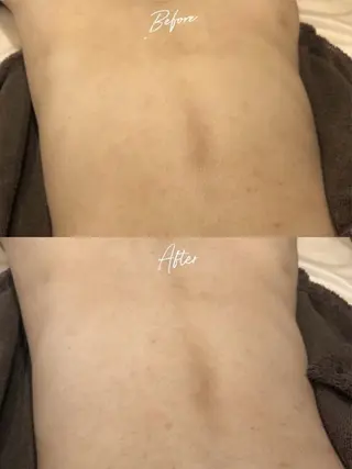 脱毛／肌質改善 《ulula~梟》のエステ・リラクイメージ