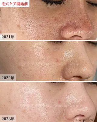 メンズ 毛穴ケア専門サロン アメリオボーテのその他イメージ