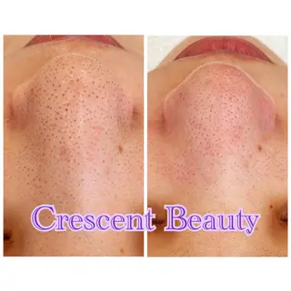 Crescent Beautyのエステ・リラクイメージ